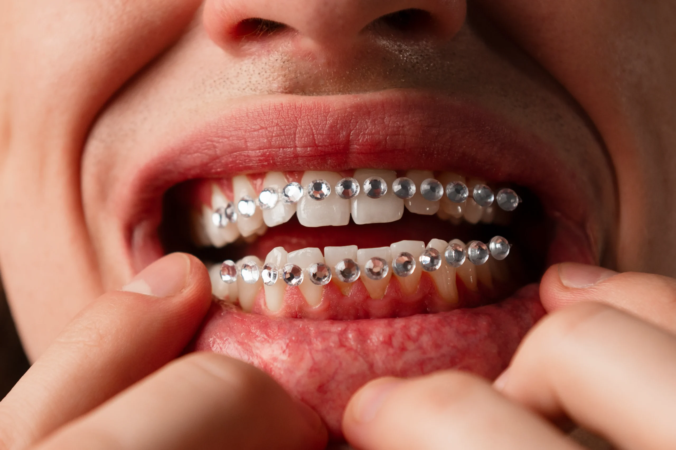 Can Oral Appliances Help Mild Sleep Apnea Symptoms?